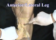 Anterior Lateral