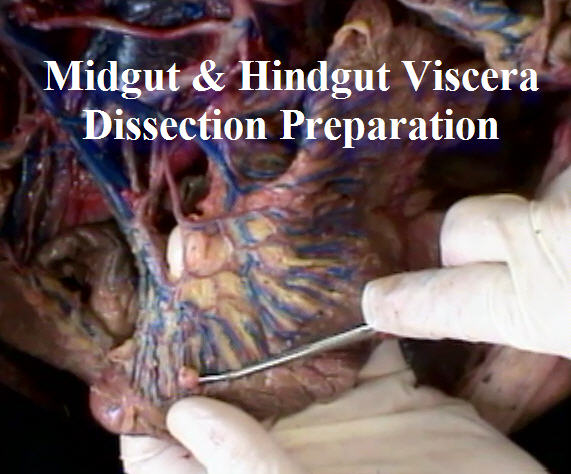 Dissection: Midgut & Hindgut Viscera - Anatomy Guy