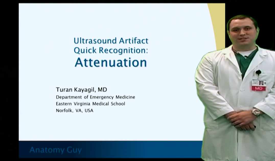 attenuation artifact meaning